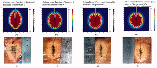 Figure 5. Numerical simulation (upper row) and experimental results (lower row) in the ex vivo porcine liver tissues after various MWA treatments. (a, e) The tissues were treated with continuous ablation; the tissues were treated under intermittent ablation with 10 s heating followed by a pause time of (b, f) 20 s, (c, g) 30 s and (d, h) 40 s for each cycle. The total ablation time in all the conditions is 300 s, and the output power is 50 W.