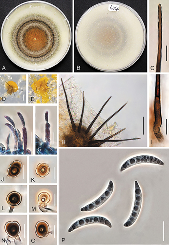 Figure 4. Colletotrichum cereale (from strain UTFC 383). A–B. Colony on OA after 7 d, A. upper and B. reverse side. C. Tip of a seta. D, E, H. Acervuli with setae. F, G. Conidiophores. I. Base of a seta. J–O. Appressoria. P. Conidia. C, F–I, P. from Anthriscus stem. D–E, J–O. from SNA. D, E. DM. C, F–P. DIC. Scale bars: D, E = 50 μm, C, F–P = 10 μm.