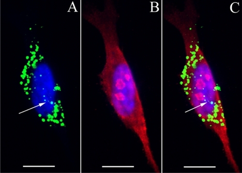 Figure 6 A HPNP vesicle pathway from the cytoplasm towards the nucleolin-positive nucleolus was observed in the primary cochlear cell culture exposed to HPNPs (arrows in A and C).Notes: Green: FITC-conjugated HPNPs. Red: nucleolin. Blue: nuclear staining by DAPI. Scale bar = 10 μm.Abbreviation: HPNPs, hyperbranched polylysine nanoparticles.