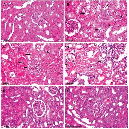 Figure 4 Photomicrograph of kidney tissue sections stained with H&E of (A) normal rat showing normal renal glomeruli and tubules. (B–D) CuO-NPs intoxicated rats showing (B) Cytoplasmic vacuolization (arrow) in some renal tubular epithelial cells and necrosis in other (arrowhead) associated with intraluminal hyaline cast (star). (C) Extensive renal tubular necrosis (arrow) with intensely eosinophilic cytoplasm and pyknotic nuclei with intraluminal aggregation of renal protein and cellular cast (arrowhead). (D) Necrotic tubular epithelium appearing with intensely eosinophilic cytoplasm and completely lysed nuclei (arrow) that are exfoliated in the tubular lumen. (E) CuO-NPs + 1 mL/kg bwt PJ group showing granular degeneration of renal tubular epithelium. (F) CuO-NPs + 3 mL/kg bwt PJ group showing regenerative renal tubules which are lined with large basophilic vesicular nuclei.