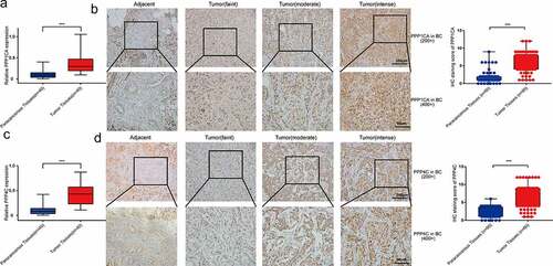 Figure 5. PPP1CA and PPP4C expression in human breast cancer tissues. The mRNA levels (a) and protein levels (b) of PPP1CA in breast cancer tissues and paracancerous tissues. The mRNA levels (c) and protein levels (d) of PPP4C in breast cancer tissues and paracancerous tissues. The data are presented as the means (minimum-maximum). All data are representative of three independent experiments. *P < 0.05, **P < 0.01, ***P < 0.001.
