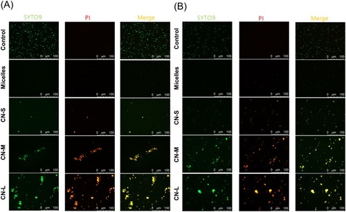 Figure 3 The live/dead imaging by treatment of micelles and squalene@CPC nanoemulsions against planktonic MRSA: (A) treatment with CPC at 10 μg/mL; and (B) treatment with CPC at 100 μg/mL.