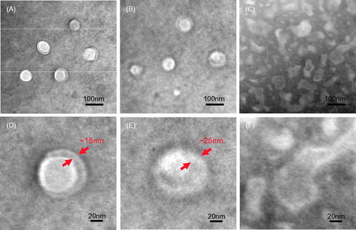 Figure 4. Typical TEM morphology of PLVs (TP/SC3-g-PLL2) in buffer at pH 2.0 (A), pH 6.0 (B) and pH 8.0 (C). Their TEM local close-up can be found in (D), (E) and (F), respectively.