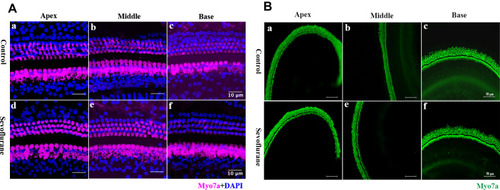 Figure 2 Hair cells were not damaged by sevoflurane. (A) Hair-cell immunohistochemistry showed no significant changes between the in vivo sevoflurane-exposure and control groups. Three well-organized rows of outer hair cells, and one row of inner hair cells are shown. Scale bar = 10 μm, n = 4. Hair cells were labeled for myosin7a (pink), and nuclei were stained with DAPI (blue). (B) Explant-culture hair cells were labelled with myosin7a (green). Scale bar = 50 μm, n = 4. Arrows indicate inner hair cells (IHC) and outer hair cells (OHC).