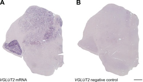 Figure 1 Coronal brain sections through the caudal thalamus of a galago. Sense and anti-sense probes for VGLUT2 confirm staining specificity for VGLUT2 mRNA and lack of secondary reactivity due to staining techniques. A) Anti-sense VGLUT2 probe stains VGLUT2 mRNA in the thalamus. B) Sense VGLUT2 probe does not stain VGLUT2 mRNA and does not show any secondary signal in the thalamus. Scale bar is 1 mm. The thalamic midline is to the right.