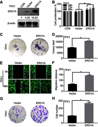 Figure 6 High expression of ERO1A enhances the proliferation and migration of CCA cells. (A) Western blotting was used to detect the expression of ERO1A after lentivirus-transfected in TFK1 cells. (B) MTT assay showed that the proliferation of TFK1 cells was enhanced. (C) Colony formation assays of TFK1 cells. (D) The statistical chart of colony formation assay. (E) Wound healing assay to detect the effects of overexpression ERO1A in CCA cells (40×). (F) The statistical chart of wound healing assay. (G) The effects of ERO1A on CCA cells migration ability were detected by migration test (200×). (H) The statistical chart of migration test. *P<0.05 vs Vector.Abbreviation: CON, control.