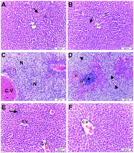 Figure 5. Histopathological changes in liver samples from all study groups. Haematoxylin and eosin (magnification ×200, scale bar = 500 mm). (A and B) Control and ARB groups, respectively, showed normal hepatic lobular architecture with regular cords of eosinophilic hepatocytes with vesicular nuclei (arrow) radiating from the central vein (C.V) separated by blood sinusoids (S). (C and D) PAR group revealed severely disturbed hepatic architecture with massive lobular necrosis and rarified areas (N), markedly congested central vein (C.V), focal hyaline deposits (H), heavy inflammatory infiltrates (star), and degenerated ballooned hepatocytes with pyknotic nuclei (arrowheads). (E) NAC + PAR group showed relatively improved liver histology, few inflammatory infiltrates (arrow), and mild central vein congestion (C.V). (F) ARB + PAR group revealed almost restored normal liver architecture with regularly arranged hepatocytes’ cords and mildly congested central vein (C.V).