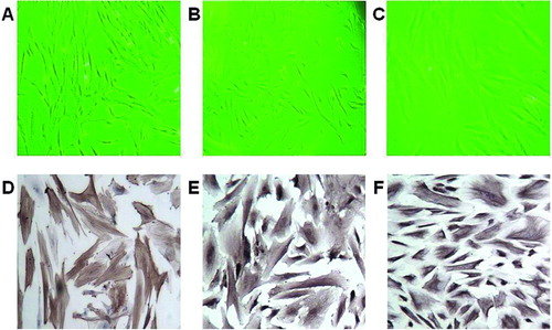 Figure 1  Typical morphology and characterization of CAFs harvested from human EOC tissues. Typical CAF morphology: (A) spindle-shaped, (B) intermediate, and (C) flattened. Positive immunohistochemical staining for (D) α-SMA, (E) vimentin, and (F) FSP1, original magnification ×200.