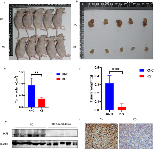 Figure 6. TCF3 promotes the progression of ESCC in vivo. a-b. Tumor appearance in mice after 1 month of subcutaneous tumor formation. c. Smaller tumor volume in the knockdown group compared to the NC group. D. Smaller tumor weight in the knockdown group compared to the NC group. e-f. Reduced TCF3 expression in the knockdown group compared to the NC group.