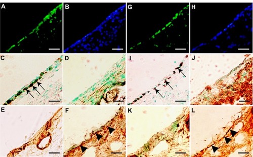 Figure 6 (A–L) Analysis of transplanted mucosal epithelial cells in recipient tissues at postoperative days 14 and 28. (A–F) Serial frozen sections of middle-ear bullae after transplantation (0.5 × 106 cells/mL) at postoperative day 14, and (G–L) postoperative day 28. (A, B, G and H) Fluorescence images at several time points. Enhanced green fluorescent protein (EGFP)-expressing cells were detected on the internal surface of recipient middle-ear bullae (green, EGFP; blue, 4′,6-diamidino-2-phenylindole) (A and G). results of immunostaining with (C and I) anti-pancytokeratin, (D and J) anti-vimentin, (E and K) anti-collagen III, and (F and L) anti-collagen IV antibody. EGFP-expressing cells were positive for pancytokeratin (C and I, arrows), but not for vimentin (D and J). Collagen III-positive regions were detected mainly in the subepithelium (E and K). Collagen IV-positive regions were detected under the monolayer structure of donor cells at 14 and 28 days after transplantation (F and L, arrowheads). Scale bars, 50 μm.