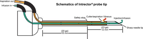 Figure 1 Technical specifications of the Intrector® (Insight Instruments Inc., Stuart, FL, USA).