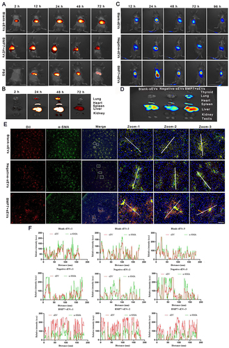 Figure 4 BMP7+sEVs in vivo biodistribution and ex vivo organ distribution. (A) In vivo biodistribution images of DiR (dissolved in PBS), blank-sEVs, and BMP7+sEVs in normal c57BL/6J mice. (B) In vivo biodistribution of blank-sEVs, negative-sEVs, and BMP7+sEVs in liver fibrosis C57BL/6J mice. (C) Major organs from healthy mice after intravenous injection with hucMSC-sEVs. (D) Fluorescence imaging of key organs in liver fibrosis mouse models 96 h following intravenous injection with DiR-labeled blank-sEVs, negative-sEVs, and BMP7+sEVs. (E) Immunofluorescence of α-SMA and sEVs in the liver tissues of C57BL/6J mice. Scale bars: 500 and 50 µm. (F) Co-quantification of hucMSC-sEVs and α-SMA fluorescence.