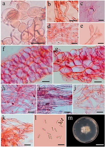 Figure 7. Microscopic features of Phallus merulinus. (a–e) Cap cells and hyphae. (f) Cells of indusium. (g) Cells of pseudostipe. (h,i) Volva hyphae. (j,k) Rhizomorph hyphae. (l) Basidiospores. (m) Colony on PDA (surface and reverse plate). Scale bars: a–b, f–g = 20 µm, c–e, h–l = 5 µm, m = 20 mm.