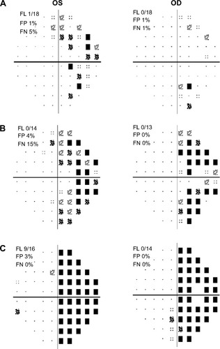 Figure 3 Humphrey visual field stimulus III 24-2 pattern deviation plots for case 2.