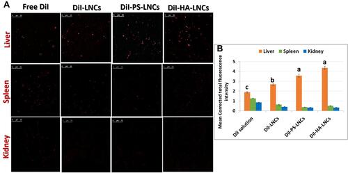 Figure 7 In vivo tissue biodistribution in rats with induced liver fibrosis. (A) Confocal laser-scanning microscopy of tissue sections at 1 hour after IP administration of different fluorescently labeled formulations (1 mg/kg) to CCl4 fibrotic rat model at excitation and emission wavelengths of 545 and 550–600 nm, respectively. Magnification 63×. (B) Calculated mean corrected total fluorescence intensity of tested formulations detected in various tissue organs after 1 hour from IP administration (1 mg/kg) to CCl4 fibrotic rat model. Data expressed as mean ± SEM (n=7), analyzed using one-way ANOVA followed by post hoc test (Duncan) for group comparisons. Means of similar symbols were statistically insignificant: a > b > c (p≤0.05).