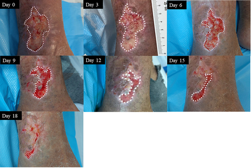 Figure 6 Representative images of the healing process in case 6.