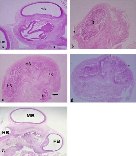 Figure 1. a. A photograph showing control group with normal structure of the brain chambers, fore brain (FB) mid brain (MB) and hind brain (HB) with clear ventricles. b–d (treated egg with formalin fumigation showing malformed and congenital head and brain), b. microcephaly with degenerated brain (B), the non-closure of the hind brain (arrow). C. Microcephaly and microophthalamic (E) embryo with Malformed and degenerated brain in collapsed cavities, absence of limitation between brain segments and non-closure of the fore brain (arrow), d. Exencephalic embryo and severe reduction of ventricles. Note non-closure of the fore and mid brain (arrows). e. Normal developed brain in the treated case with either oregano or cumin oils.
