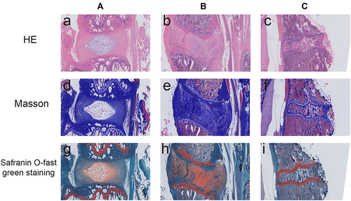 Figure 2 Histopathology of panels A-C. HE staining image of the sagittal section (A–C). Masson staining image of sagittal section (D–F) and Safranin O-fast green staining of sagittal section (G–I) both showed that compared with group A, the IVD of group B and group C was less Order and looser, containing a large number of inflammatory cells and scarring.