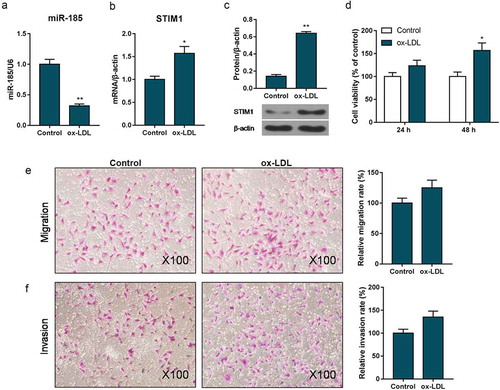 Figure 1. miR-185 was low expressed and STIM1 was high expressed in ox-LDL treated MOVAS cells. MOVAS cells were subjected to ox-LDL. (a-c) The expression of miR-185 and STIM1were detected by RT-qPCR (a, b) and Western blot (c). CCK-8 was applied to measure cell viability. (e, f) Transwell assay was carried out to analyze cell migration (e) and invasion (f). *P< 0.05, **P< 0.01, versus control.