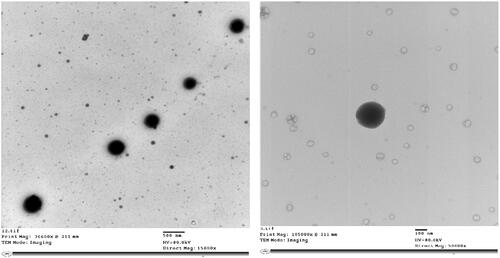 Figure 4. Transmission electron micrographs of the optimized CLZ-loaded PNMS at different magnifications.