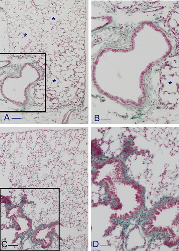 Figure 2. Representative lung parenchyma from Lck and p66Shc knockout mice after Masson’s trichrome stain. At 7 months after cigarette smoke exposure, lung parenchyma from Lck deficient mice show patchy areas of emphysema (*) throughout the parenchyma (A) and a mild deposition of extracellular matrix in peribronchiolar areas (A). (B) is higher magnification of (A) showing a peribronchiolar area with slight increase of collagen deposition (“sea green area”). At 7 months from the start of the treatment smoking p66Shc deficient mice show significant collagen deposition (“sea green areas”) in the peribronchiolar spaces throughout the lung parenchyma (C). These changes are not associated with significant areas of emphysema. (D) is higher magnification of (C). Scale bars = (A and C) 100 µm; (B and D) 50 µm.