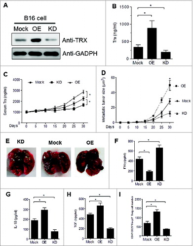 Figure 2. TRX levels correlate with the Treg number in the tumor microenvironment to inhibit T-cell response. (A) Western bolt analysis of thioredoxin (TRX) protein level in B16 cells transfected with empty vector (Mock) or pcDNA3.1-TRX overexpression (OE) or TRX shRNA knockdown (KD). (B) ELISA analysis of TRX protein level in serum-free conditioned medium from transfected B16 cells cultured 24 h. (C) ELISA analysis of serum TRX protein level in blood sera of B16 tumor-bearing mice. (D) Metastatic tumor size in lung from B16 cell tumor-bearing mice (n = 6). (E) Representative image of lung metastases from B16 tumor bearing mice at day 30. (F-H) ELISA analysis of serum interferon γ (IFNγ), interleukin 10 (IL10) and transforming growth factor β (TGFβ) protein levels from tumor-bearing mice (n = 6) 20 d after B16 cell injection. (I) Transfected B16 cells were injected into C57/B6 mice for 3 weeks then tumor-infiltrating regulatory T cell (Treg) numbers per 200 mg tumor sample were calculated in tumor-bearing mice (n = 6) by immunofluorescence staining and cytofluorimetric analysis. Statistical analysis was performed by Student's t-test; *P < 0.05.