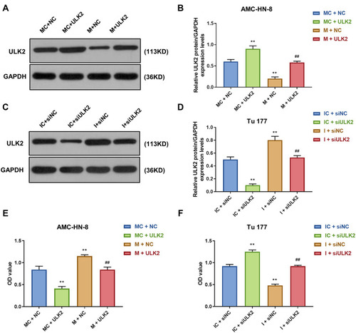 Figure 9 Overexpression of ULK2 rescued the inhibitory effects of miR-26a-5p mimic on AMC-HN-8 cells proliferation. Transfection efficiency of ULK2 in AMC-HN-8 cells was confirmed (A) and quantified (B) by Western blot. Transfection efficiency of ULK2 in Tu177 cells was confirmed (C) and quantified (D) by Western blot. (E) AMC-HN-8 cells viability was tested by CCK-8 assay. (F) Tu177 cells viability was tested by CCK-8 assay. **P<0.01 vs MC+NC or IC+siNC, ##P<0.01 vs M+NC or I+siNC.
