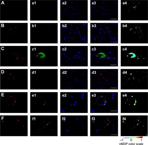 Figure 8 Representative images of brain immunofluorescence using anti-BBB and anti-GFAP in control and gH625-treated animals.Notes: From left to right, the columns show AlexaFluor594, fluorescein isothiocyanate, DAPI, and merged and colocalization map images, respectively. For the colocalization map (from -1 to 1) a color scale is provided: negative indices (cold colors) represent no colocalization, while indices above 0 (hot colors) represent colocalization. (A–a4) Negative control (omission of primary antibody) for anti-BBB immunofluorescence in control animal (vehicle or gH625 without NBD) showing low red background and no green signal (anti-GFAP negative control showed the same pattern and is not shown). Scale bar corresponds to 50 μm. (B–b4) Anti-GFAP immunofluorescence in a control animal. Scattered spots of low green signal were due to red blood cells. Scale bar 50 μm. (C–c4) Anti-GFAP immunofluorescence in a gH625-treated animal showing no overlapping of red and green signal. Scale bar corresponds to 20 μm. (D–d4) Anti-BBB immunofluorescence in a control animal. Scattered spots of low green signal can be attributed to red blood cells. Scale bar corresponds to 50 μm. (E–e4) Anti-BBB immunofluorescence in a gH625-treated animal showing overlapping of red and green signal. Scale bar corresponds to 20 μm. (F–f4) Anti-BBB immunofluorescence in a gH625-treated animal showing that the presence of gH625 beyond the BBB can be associated to nerve cell processes. Scale bar corresponds to 20 μm.Abbreviations: BBB, blood–brain barrier; GFAP, glial fibrillary acidic protein; NBD, 7-nitrobenz-2-oxa-1,3-diazole-4-yl; DAPI, 4,6-diamidino-2-phenylindole; nMDP, normalized mean deviation product.