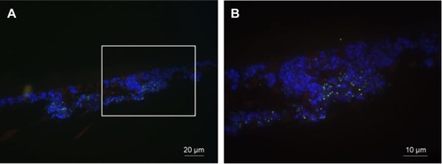 Figure 10 Detailed section of sessile Staphylococcus epidermidis hybridized with pan-bacterial EUB 338FITC and staphylococci-specific STAPHYFITC probes (green) as well as stained with DAPI (blue) after 24 hours incubation with 20 mg/mL of daptomycin-loaded PCL microparticles.Notes: Magnification: (A) 400× and (B) 1,000× (B corresponds to magnification of the boxed area of the biofilm of A).Abbreviations: DAPI, 4′,6-diamidino-2-phenylindole; PCL, poly-epsilon-caprolactone.