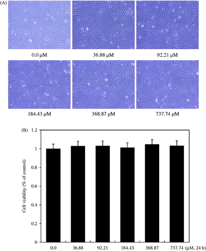 Figure 4. Effect of isoimperatorin treatment on the viability of rabbit articular chondrocytes. Chondrocytes were treated with the indicated concentrations (0.0–737.74 μM) of isoimperatorin for 24 h. Photographs of chondrocytes (A) were taken with a phase-contrast microscope (200× magnification). Cell viability was estimated using the methyl thiazole tetrazolium (MTT) assay. The graphical data (B) are expressed as mean ± standard error of mean.