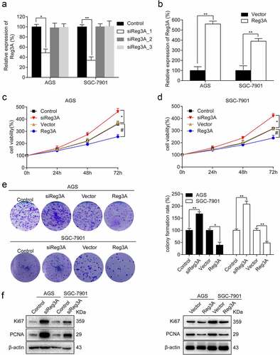 Figure 3. Reg3A inhibits cell proliferation in GC cells. Reg3A was (a) knocked down and (b) overexpressed. Reg3A regulates (c, d) cell viability, (e) clone formation, and (f) proliferation-related proteins. *, # P < 0.05; **, ## P < 0.01