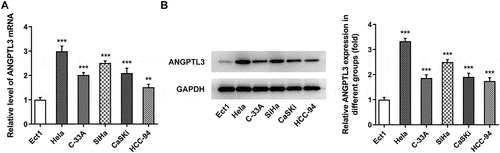 Figure 1. ANGPTL3 is highly expressed in cervical cancer cells. (a) mRNA level of ANGPTL3 in cervical cancer cell lines detected by qRT-PCR. (b) Protein level of ANGPTL3 in cervical cancer cell lines measured by Western blot assay. Results are expressed as mean ± SD. **p < 0.01, ***p < 0.001 versus control.