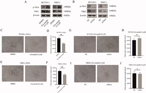 Figure 4. TrkA knockdown did not reverse the antiangiogenic effects of GA-amide on HUVECs and NhECs. (A) p-TrkA levels in HUVECs and NhECs after treatment with 0.2 μM GA-amide for 6 h were evaluated by Western blot. (B) TrkA and p-TrkA expression levels in HUVECs and NhECs after treatment with siTrkA were evaluated by Western blot. (C) Representative images showing the antiangiogenic effects of GA-amide on TrkA knockdown HUVECs. (D) Quantitative analysis of C. (E) Representative images showing the antiangiogenic effects of GA-amide on TrkA-knockdown NhECs. (F) Quantitative analysis of (E). (G) Representative images showing the antiangiogenic effects of GA-amide on normal and TrkA-knockdown HUVEC. (H) Quantitative analysis of (G). (I) Representative images showing the antiangiogenic effects of GA-amide on normal and TrkA knockdown NhECs. (J) Quantitative analysis of (I). Images were taken under a phase-contrast microscope at 100× magnitude. Images were analyzed by the ImageJ software, and the numbers of capillary-like structures in five separated fields of one well was calculated. Scale bar, 200 μm. Data are presented as the mean ± S.D. of three independent determinations. **p < 0.01 compared with the DMSO by two-tailed Student’s t-test.