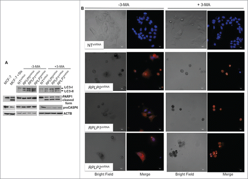 Figure 4. Inhibition of autophagy in cells with downregulated RPLP protein expression induces apoptosis. (A) Representative immunoblot of LC3, PARP1 cleavage, and proCASP6 in MCF-7 cells expressing RPLP0 shRNA, RPLP1 shRNA, RPLP2 shRNA, or NT shRNA vector, in the absence (DMSO) or presence of 10 mM 3-MA for 48 h. ACTB was used as a loading control. Note the presence of PARP1 cleavage and the decrease in proCASP6 in MCF-7 cells treated with Sts and also in MCF-7 cells expressing RPLP0 shRNA, RPLP1 shRNA, and RPLP2 shRNA compared with control cells (NT shRNA) following treatment with 3-MA (as in A), indicative of apoptosis. (B) Acridine orange staining counterstained with Hoechst in MCF-7 cells expressing RPLP0 shRNA, RPLP1 shRNA, RPLP2 shRNA, or NT shRNA vector, in the absence or presence of 10 mM 3-MA (as in A). Representative confocal microscopy images of control (DMSO) RPLP protein-deficient cells with punctate staining of autophagosomes (left part). The acridine orange cytoplasmic pattern is blocked by the autophagy inhibitor 3-MA (on the right), resulting in acridine orange-positive nuclear staining and morphological changes that are characteristic of apoptosis. Scale bar: 20 μm.