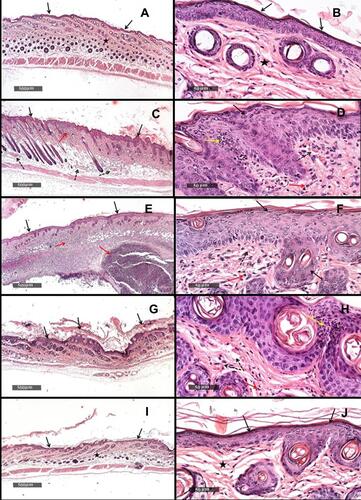 Figure 11 (A) Dorsal skin micrograph of healthy mice under X500um magnification, (B) dorsal skin micrograph of healthy mice under X50um magnification, (C) dorsal skin micrograph of mice receiving 5%IMQ only under X500um magnification, (D) dorsal skin micrograph of mice receiving 5%IMQ only under X50um magnification, (E) dorsal skin micrograph of mice receiving 5%IMQ and void cubosomes in 1%SCMC under X500um magnification, (F) dorsal skin micrograph of mice receiving 5%IMQ and void cubosomes in 1%SCMC under X50um magnification, (G) dorsal skin micrograph of mice receiving 5%IMQ and commercial BDSA lotion under X500um magnification, (H) dorsal skin micrograph of mice receiving 5%IMQ and commercial BDSA lotion under X50um magnification, (I) dorsal skin micrograph of mice receiving 5%IMQ and tested cubosomal BDSA dispersion in 1%SCMC under X500um magnification, (J) dorsal skin micrograph of mice receiving 5%IMQ and tested cubosomal BDSA dispersion in 1%SCMC under X50um magnification.