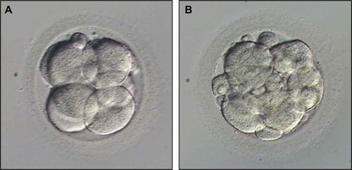 Figure 2. Embryo quality examples were given: (A) Top quality embryo (Less than 10% fragmentation and consisting of 7–8 even-sized blastomeres on day 3 without any vacuolization, granulation and multinucleation; (B) Bad quality embryo (More than 10% fragmentation and/or uneven-sized blastomeres and/or with vacuolization, granulation and multinucleation.
