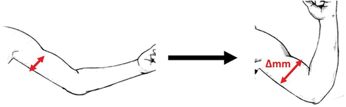 Figure 1. Illustration of electroactive capacitive sensor (surface mechanomyography) application across the bulk of a muscle and lengthens as the muscle contracts (depicted in red).