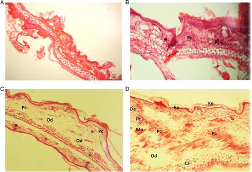 Fig. 1 Histopathology sections of mouse ear biopsies representing keratin, epidermal, dermal, and cartilage layers (magnification xl00). Harry's hematoxylin-eosin stained sections were scored as mild (+), moderate (+ + ), and severe (+ + +) for edema and substantial inflammatory mononuclear and/or polymorphonuclear cell infiltration in the dermis inflammation phase. (A) no treatment; (B) rose geranium essential oil treatment: edema (−); inflammatory cell infiltration (+), inflammation phase (±). (C) and (D) croton oil: edema (+ + +); inflammatory cell infiltration (+ + ), inflammation phase (+ + ).Ke: keratin; Ep: epidermal layer; De: dermal layer; Mu: muscle; Ca: cartilage layer; Od: edema; Pc: polymorphonuclear cell infiltration.