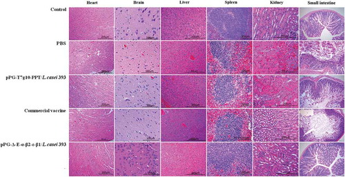 Figure 10. Histopathological changes of immunized mice post-challenge. After challenged with C. perfringens, histopathological changes were observed in the intestine, kidney, liver, spleen, heart, and brain of immunized mice with the pPG-Δ-E-α-β2-ε-β1/L. casei 393, pPG-T7g10-PPT/L. casei 393, commercially available vaccine, and PBS. Sections were stained with hematoxylin and eosin, and photographed at 40× magnification.