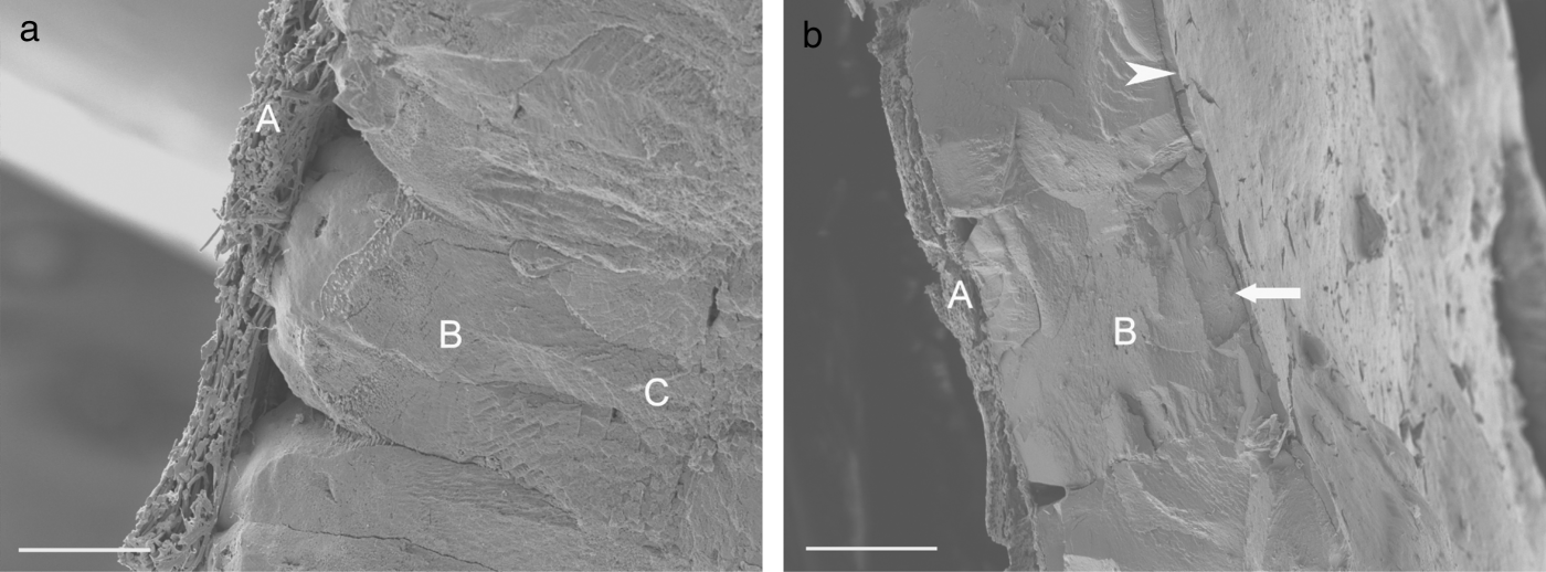 Figure 5.  5a: SEM image of an unaffected eggshell showing the inner membranes (A), the mammillary knob layer (B) and part of the palisade layer (C). Bar = 50 µm. 5b: SEM image of an abnormal apical eggshell. The mammillary knob layer is absent and only part of the palisade layer is present: inner membranes (A), palisade layer (B), vertical layer (arrow) and cuticule (arrowhead). Note also the increased density of the inner membranes. Bar = 100 µm.
