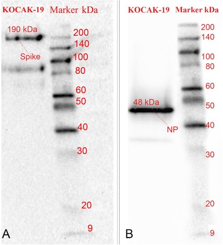 Figure 7. A. SARS-COV-2 Spike bands, approx.190 kDa B. Nucleoprotein bands, approx. 48 kDa in Western Blotting