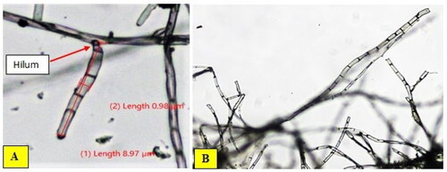 Figure 6. Hilum and mycelia septation of B. oryzae (isolate MCBO 6 C).