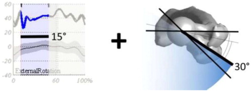 Figure 1. Illustration of kinematic and structural thresholds for femoral derotation.