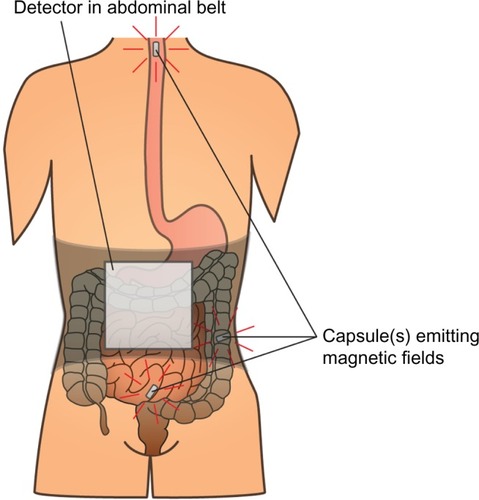 Figure 1 Principle of the motility tracking system for evaluation of gut motility.