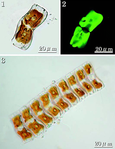 Figs 1–3. LMs of living cells showing chloroplasts. Fig. 1. Girdle view of single cell showing two large plastids, one on either side of the median transapical plane, each with a rounded pyrenoid. Fig. 2. CLSM of individual in Fig. 1 showing autofluorescence of the two plastids. Fig. 3. Colony of nine cells. Colonies are usually epiphytic on filamentous algae and attached by a stalk secreted by the lowermost cell.