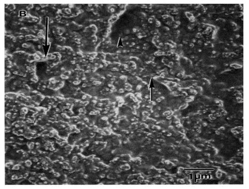 Figure 1 Nanometer roughness of vascular tissue. Previous studies have demonstrated highly irregular nanostructured surface features yet to be duplicated in metals used as vascular stents. Scale bar = 1 μm. Source: CitationFleming RG, Murphy CJ, Abrams GA, et al. 1996. Effects of synthetic micro- and nanostructured surfaces on cell behavior. Biomaterials, 17:2087–95. Copyright © 1996. Obtained and reprinted with permission from Elsevier.