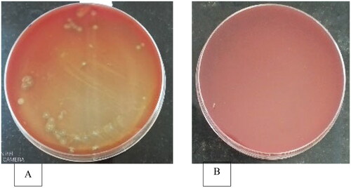 Figure 1. Isolation of potential biosurfactant producing microbes using hemolysis test.