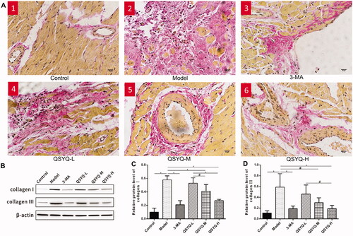 Figure 1. Effect of QSYQ on myocardial collagen in rats. (A) Representative pictures of myocardial VG staining (×400). (B) Western blot analysis of protein in the myocardium of rats. (C) The relative protein level of type I collagen in the myocardium. (D) The relative protein level of type III collagen in the myocardium. *p < 0.01, #p < 0.05.