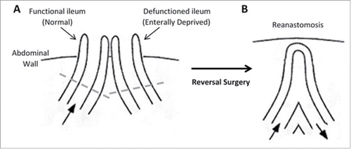 Figure 1. Structure of the intestine. (A) Loop ileostomy and (B) following reanastomosis. Block arrows denote presence and direction of luminal contents flow. Tissue located above dashed lines represent areas of intestine removed before reanastomosis and form the specimen acquired for our research.