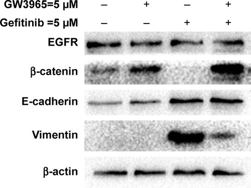 Figure 3 Western blots demonstrating that the GR cell line, HCC827/GR-8-1, demonstrated markedly increased levels of vimentin, and that treatment with gefitinib led to the complete absence of β-catenin protein expression.